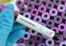 افغانستان تا دو هفته دیگر وارد مرحله جدی‌تری ویروس کرونا می‌شود